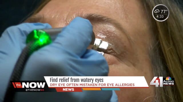 Find relief from dry eye syndrome