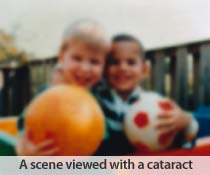 health-cataract